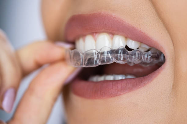 Penrith Dental Tindale Smile Studio Invisalign